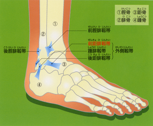 足関節捻挫_02