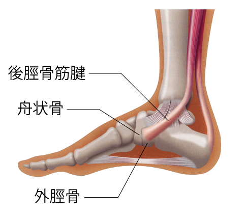 外脛骨障害_02