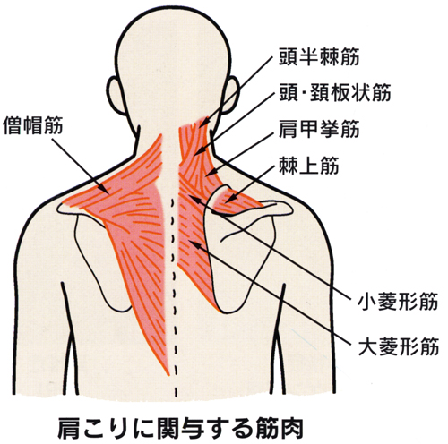 肩こり_02