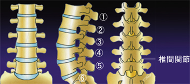 腰椎椎間関節症_01